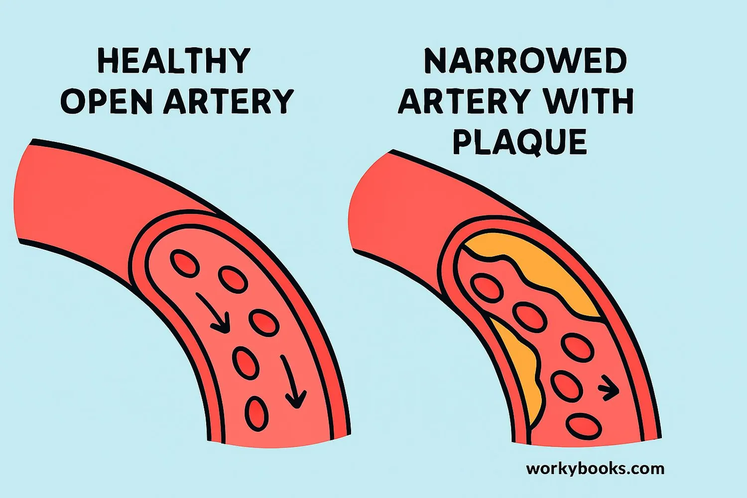 Illustration showing how healthy arteries versus clogged arteries affect blood flow